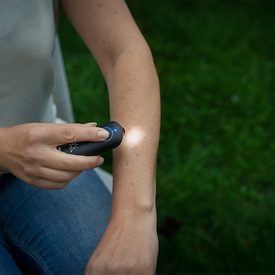 Beurer BR 90 insektstikbid/myg healer