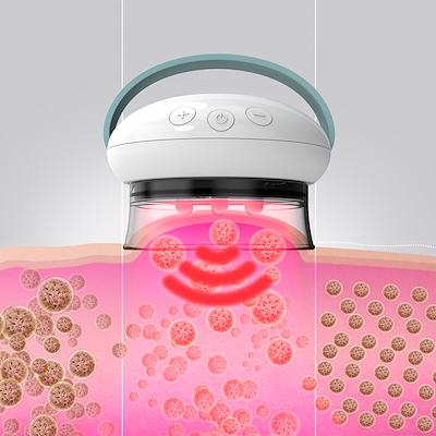 Homedics Smothee IR cellulite vacuum massager